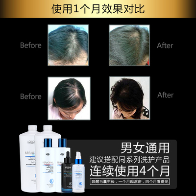 科技賦能防脫，歐萊雅芯基源洗護套裝 深入發芯，重塑強韌發絲